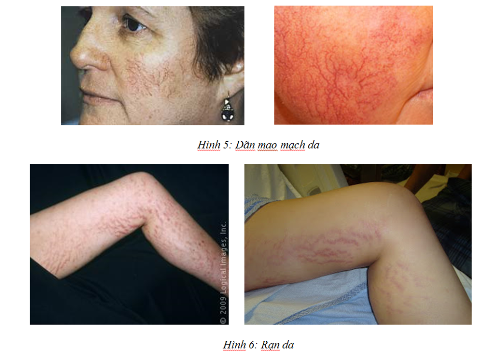 Đẹp Thuần Khiết