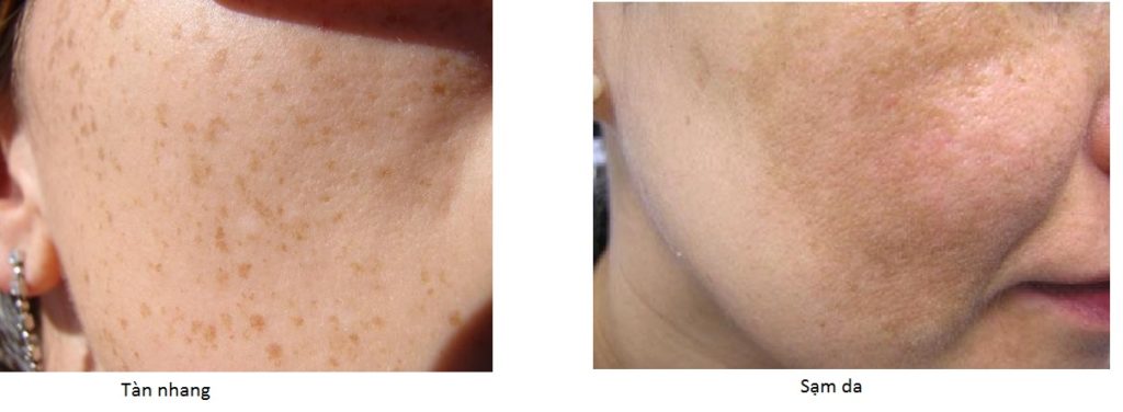 Đẹp Thuần Khiết